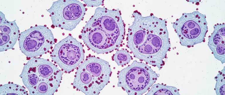 раковые клетки под микроскопом