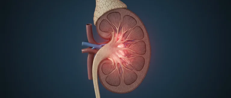 Почечная инфекция с болями в спине