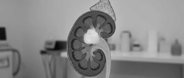 УЗИ почек при инфекции