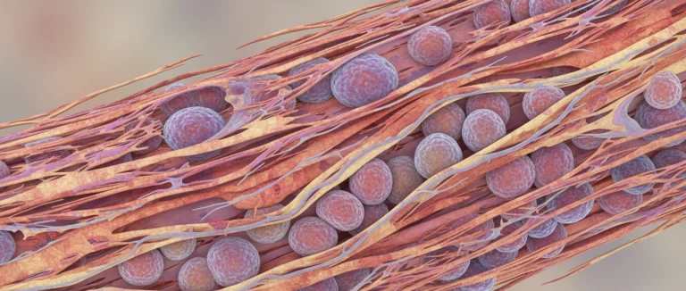 Воспалённое сухожилие под микроскопом