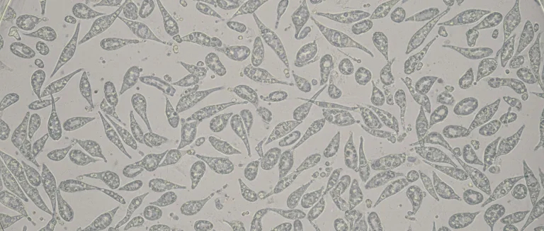 Микроскопическое изображение мезенхимальных клеток