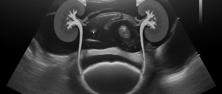 Медицинская визуализация: УЗИ почек