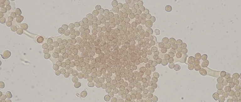 Эмбриональные стволовые клетки под микроскопом