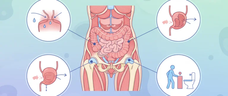Диаграмма типов недержания