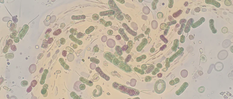 Микроскопический вид бактерий в моче
