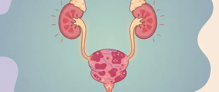 Схема поражения мочевых путей при ИМП