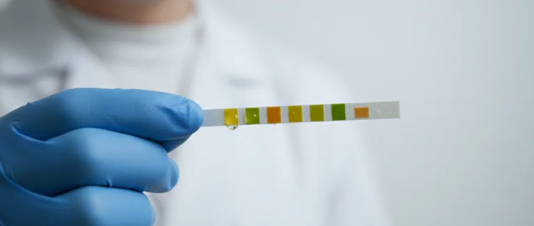 Тест‑полоска в руке врача