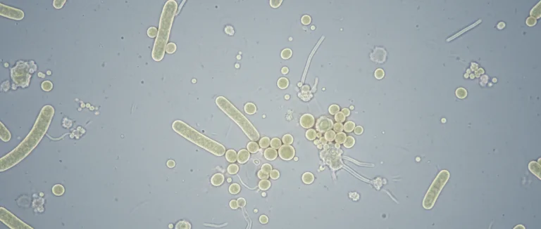 Микроскопическое изображение бактерий в моче