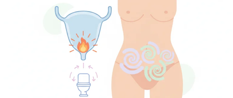 Схематическое изображение симптомов инфекции мочевого пузыря