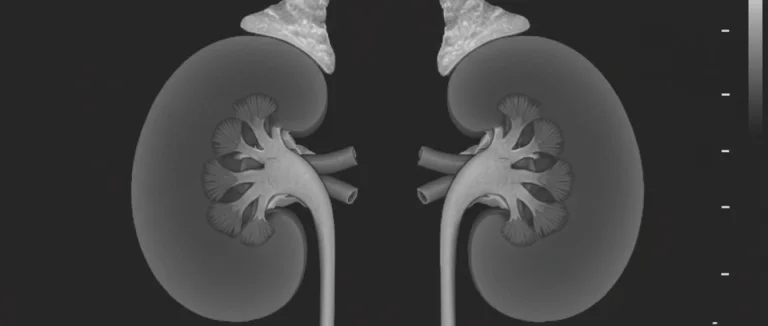 УЗИ почек: изображение без камней