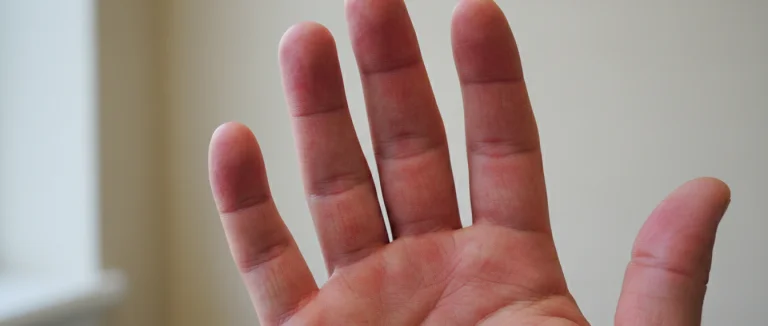 Боль в пальцах руки