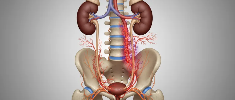 иллюстрация связи инфекции мочевых путей и боли в спине