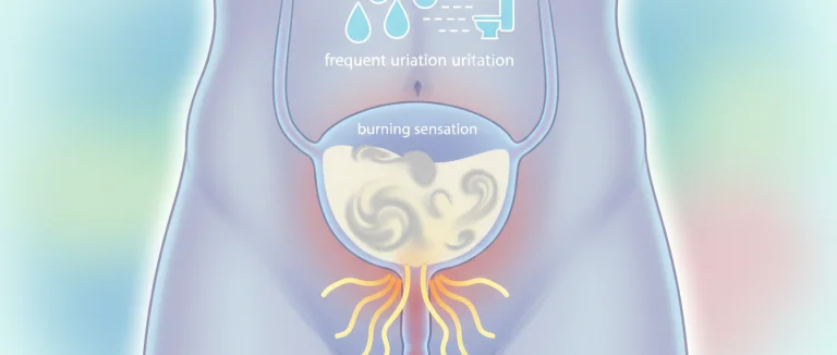 Симптомы инфекции мочевых путей