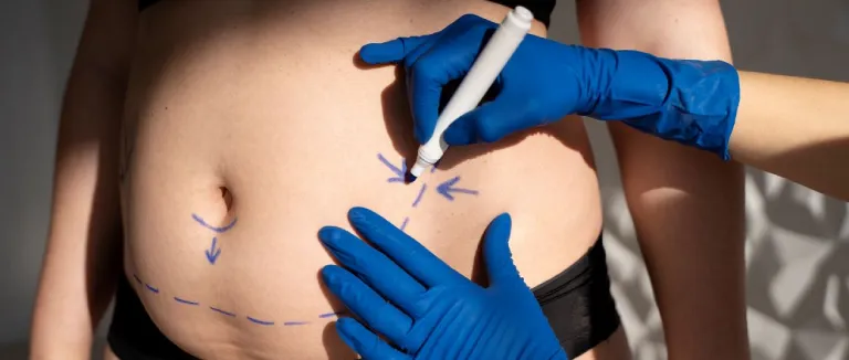 chirurgie-plastique 3