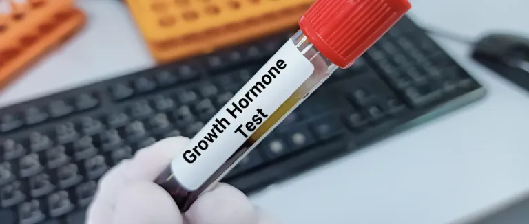 Acromegaly Treatment