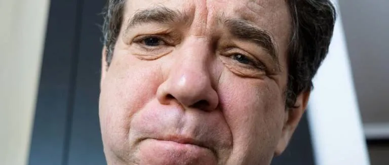 Akromegali Belirtileri