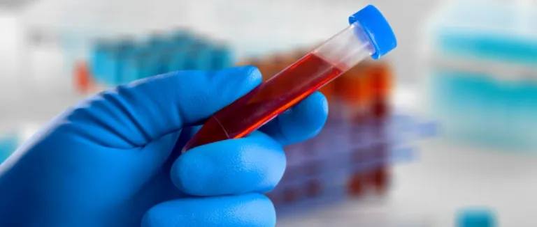 Albümin Yüksekliği