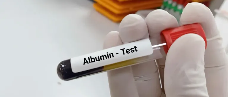 Albümin Yüksekliği