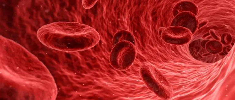 Ateroskleroz Teşhis ve Tedavisi