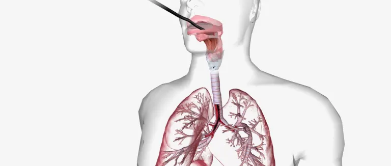 Bronkoskopi İşleminin Aşamaları Nelerdir?