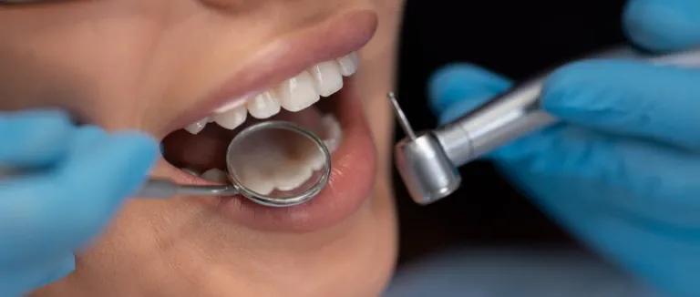 Diş Taşı Temizliği