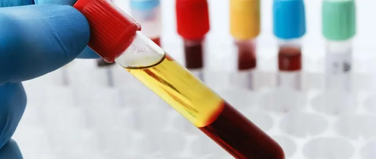 Quel est le Niveau Normal d'Hémoglobine dans le Sang?