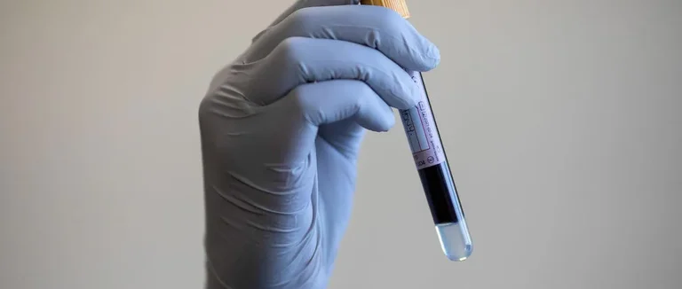 7 High HB Symptoms: Signs and Effects of Elevated Hemoglobin