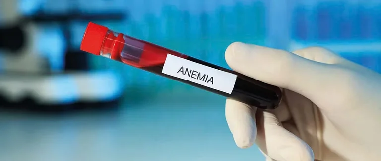 L'anémie peut-elle causer la mort ? Ce que vous devez savoir