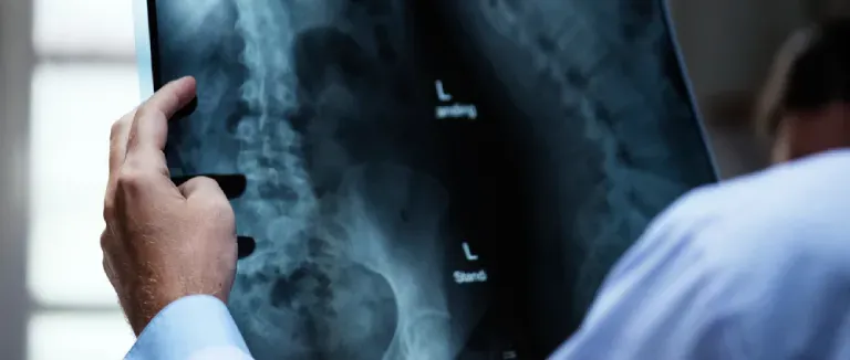 Kemik Dansitometresi