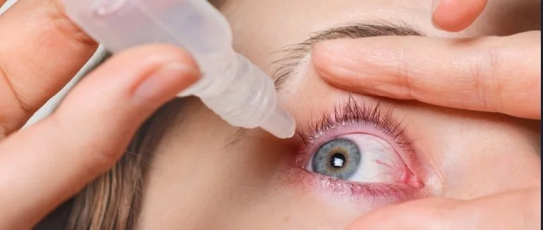 Konjonktivit tedavisi