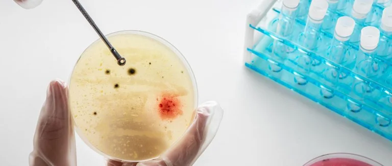 Le Cancer de la Prostate de Stade 4 Est-il une Condamnation à Mort ?