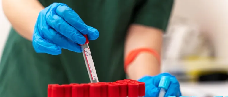 PDW Yüksekliği Neden Olur?