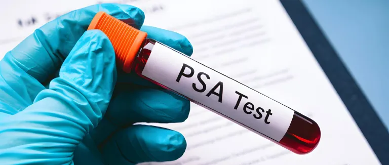 PSA Testi
