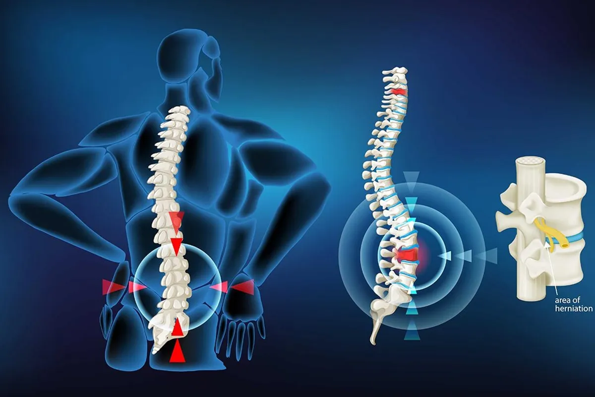 КТ-сканирование