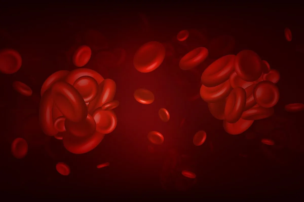 Как Распознать и Предотвратить Тромбы в Артериях