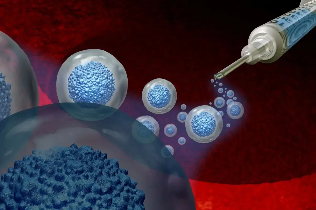 Аутологичная трансплантация