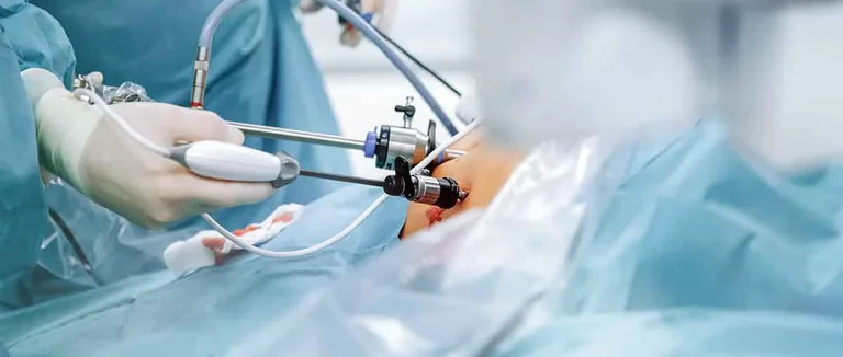 Эндоскопическое шунтирование