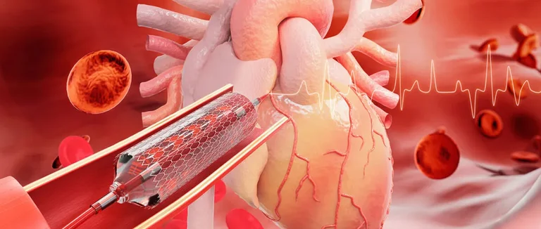 Эндоскопическое шунтирование