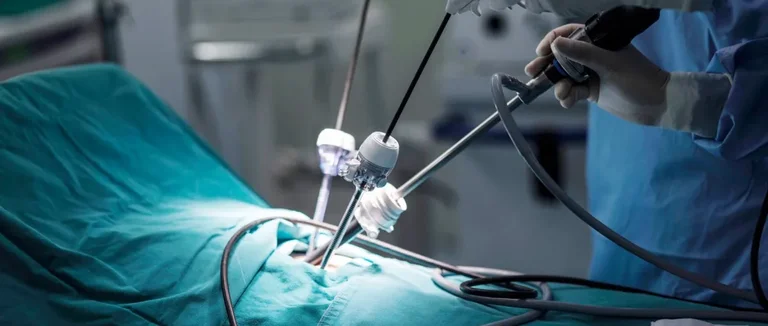 эндометриоз