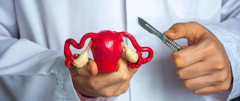 Миомэктомия