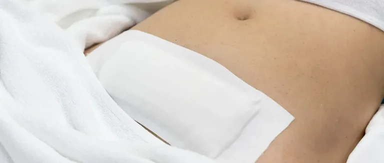 Миомэктомия 