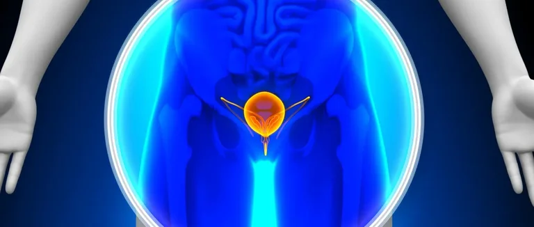 Что Такое Шкала Глисона при Раке Предстательной Железы?