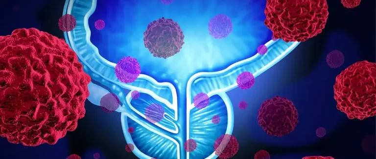 шкала Глисона