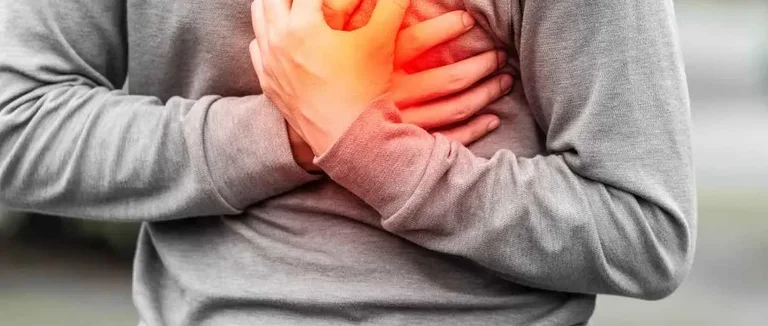 Сосудистое кольцо,