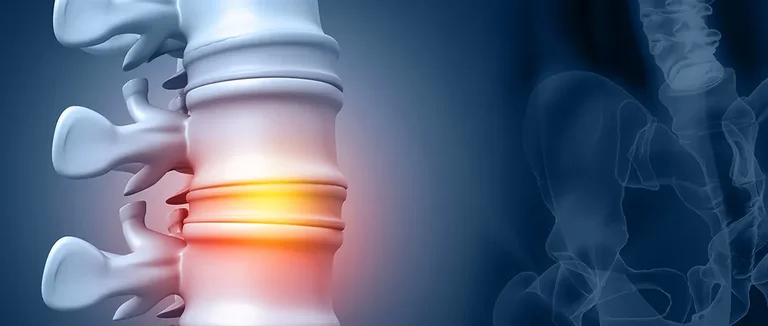 Дискэктомия