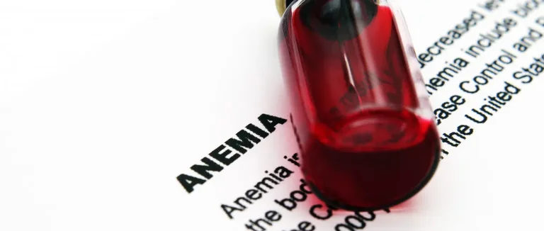 Анемия