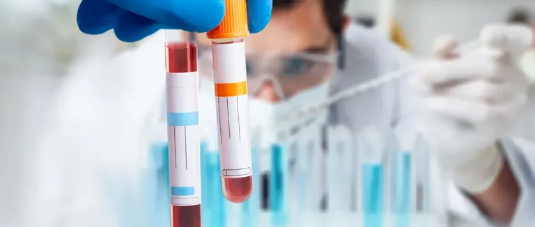 Железодефицитная анемия