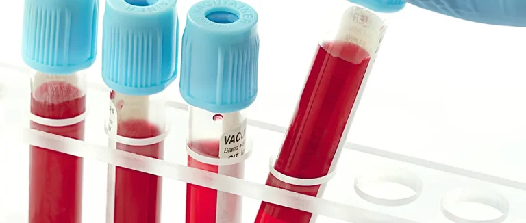 Гемоглобин