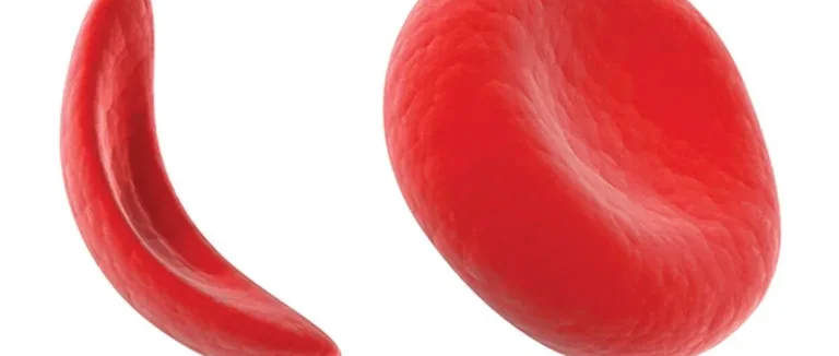 Гемоглобин C