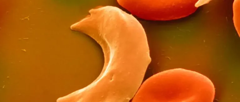 Гемоглобин C